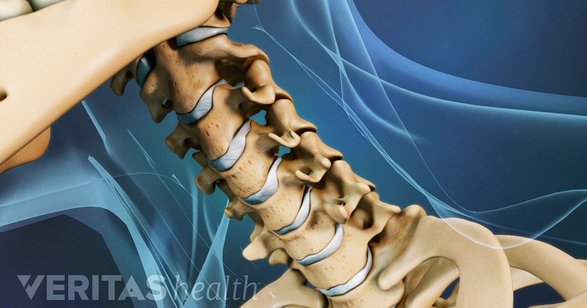 Dolor de espalda cuello y hombro izquierdo